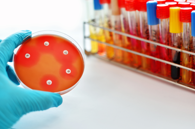 Atsparumas antibiotikams – problema, kurią sprendžiame šiandien