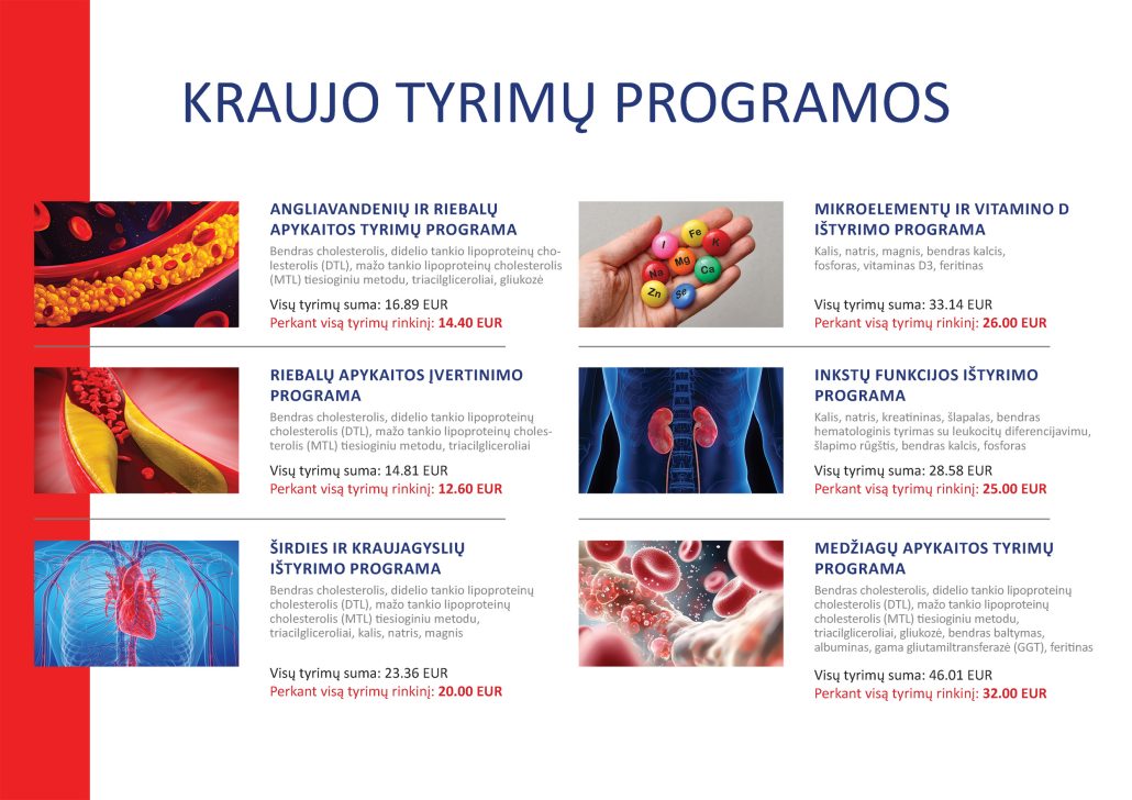 4a3-1 laboratorijos tyrimai