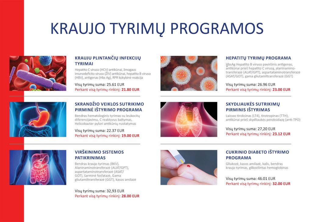 4a3-2 laboratorijos tyrimai