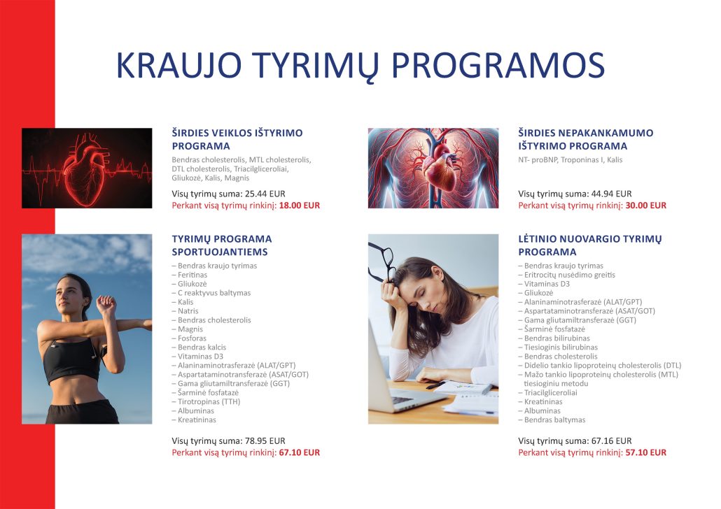 4a3-3 laboratorijos tyrimai